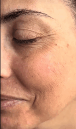 Super PROMO 2x1 - Crema reafirmante con péptidos - BOTOX Natural