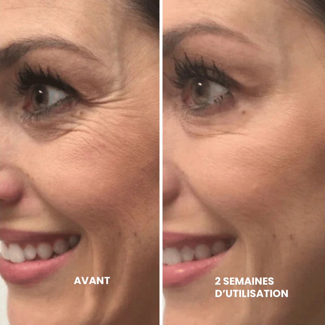 LLeva 2x1 Retivelle™ La alternativa de última generación al retinol